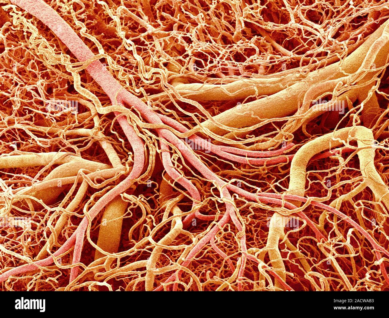 кровеносный сосуд 9 букв. строниеартеий вен капилляров. тромбоэмболия кровеносного сосуда. таблица сосуды вены артерии. строение кровеносных сосудов артерии.