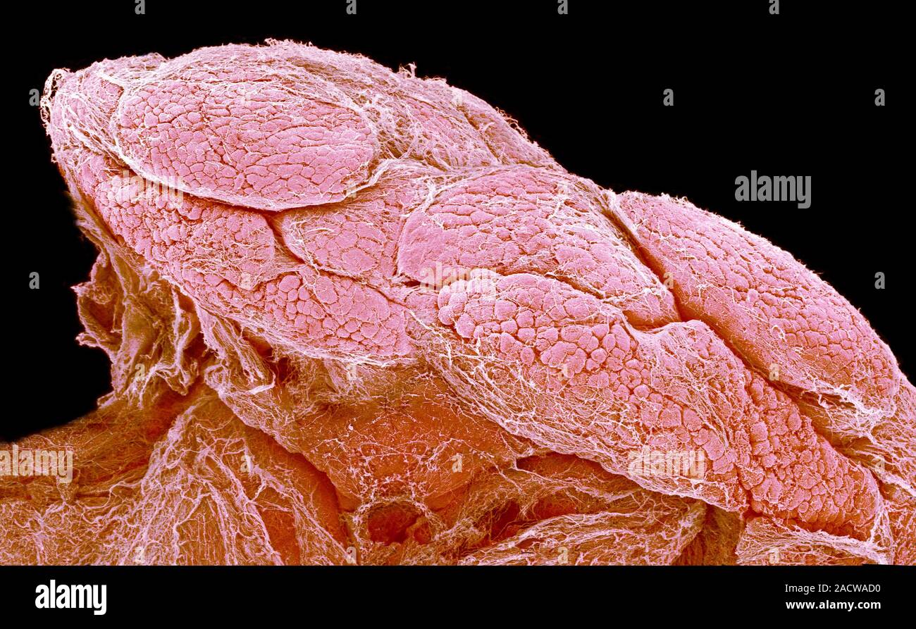 Lacrimal gland, coloured scanning electron micrograph (SEM). The