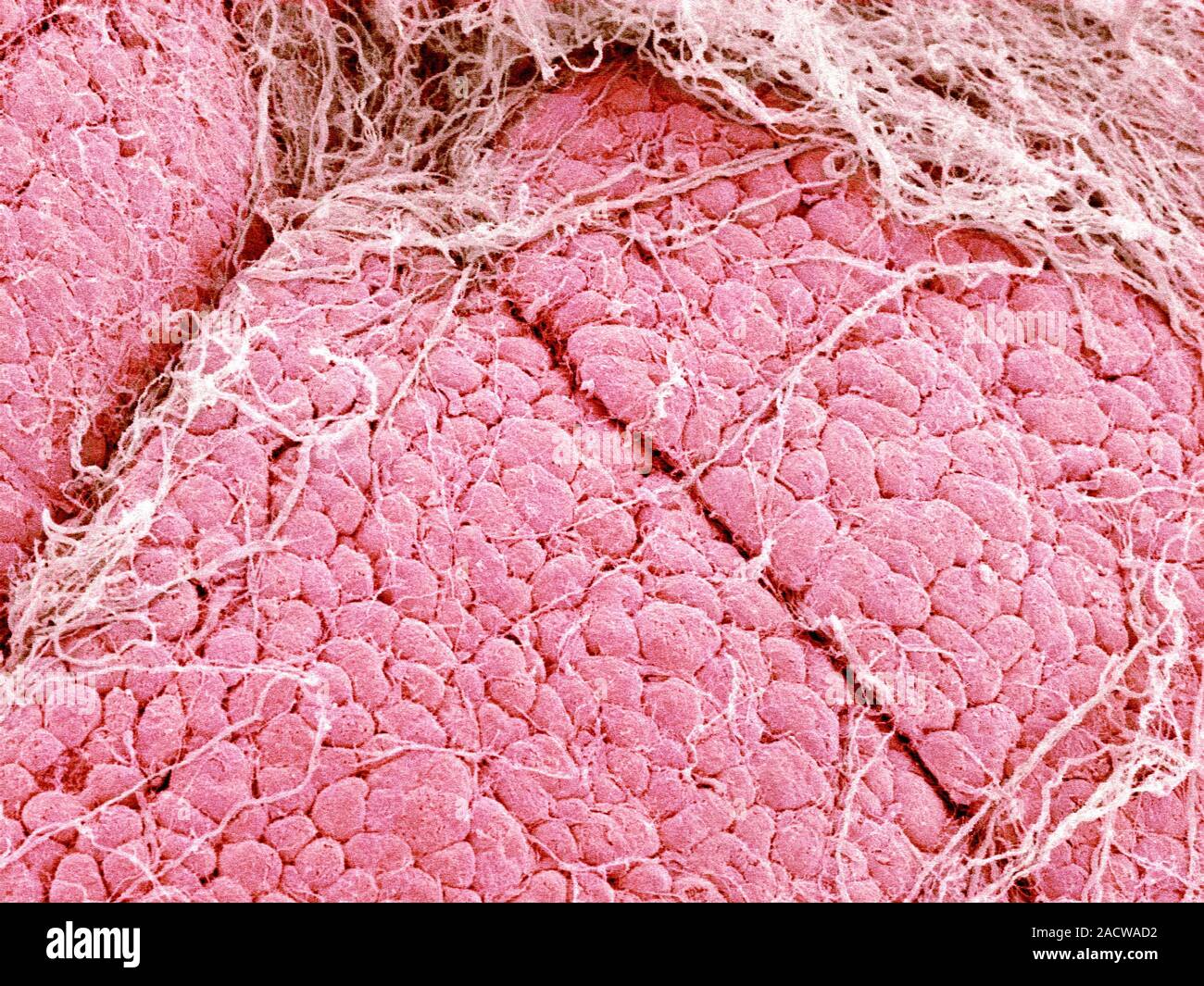 Lacrimal gland, coloured scanning electron micrograph (SEM). The