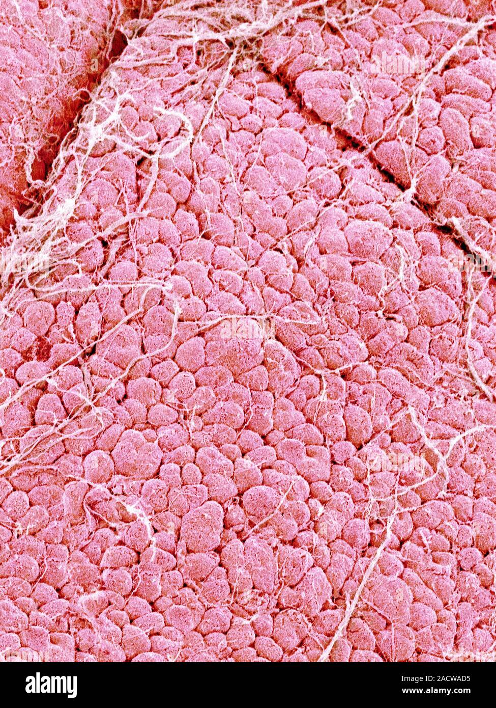 Lacrimal gland, coloured scanning electron micrograph (SEM). The