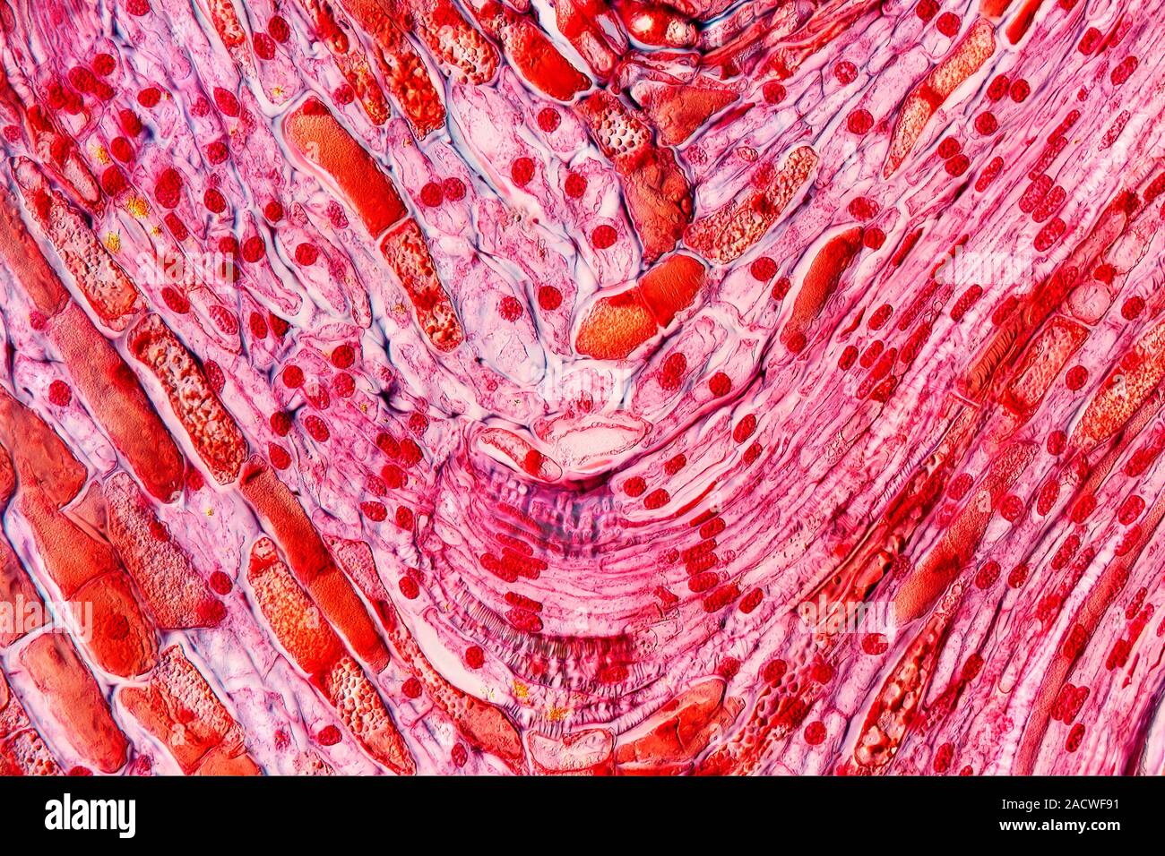 Pine cone tissue. Light micrograph of a section through a female cone ...