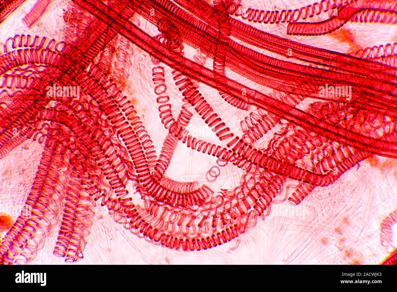 Plant vascular bundles. Light micrograph of a section through vascular ...