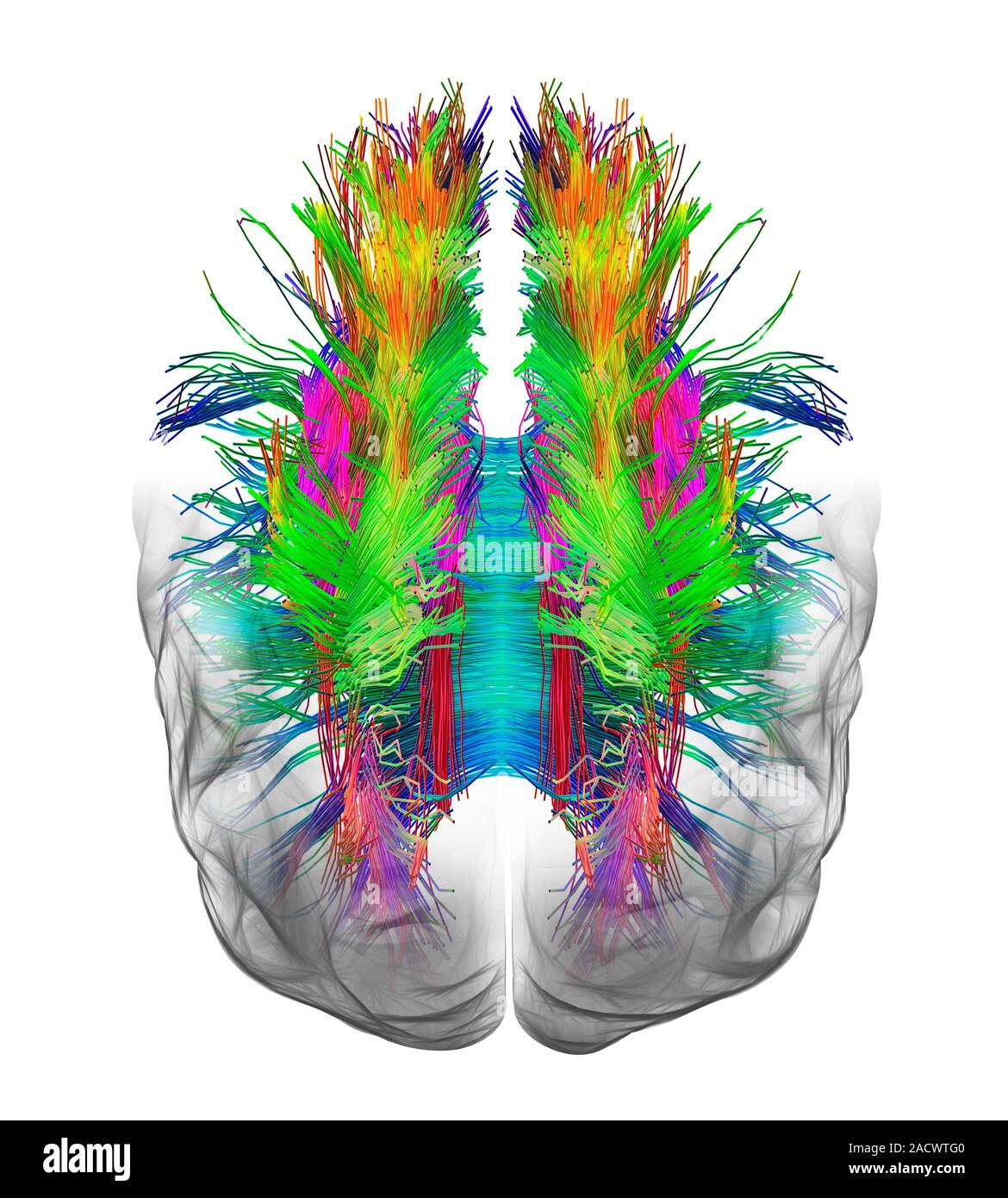 White matter fibres overlaid a 3d model of the human brain in top view ...
