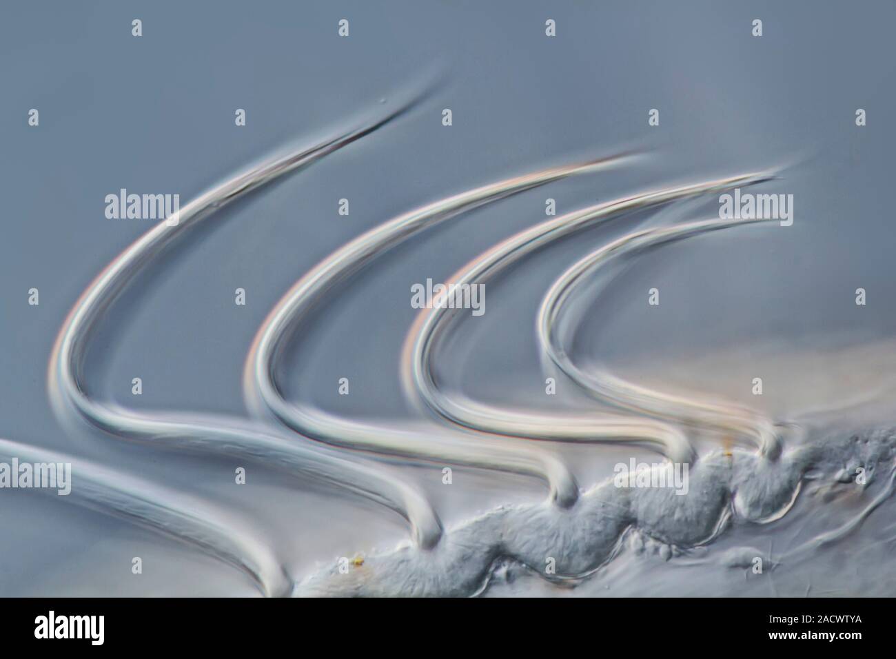 Light micrograph of a small species of sea gooseberry (Pleurobrachia sp
