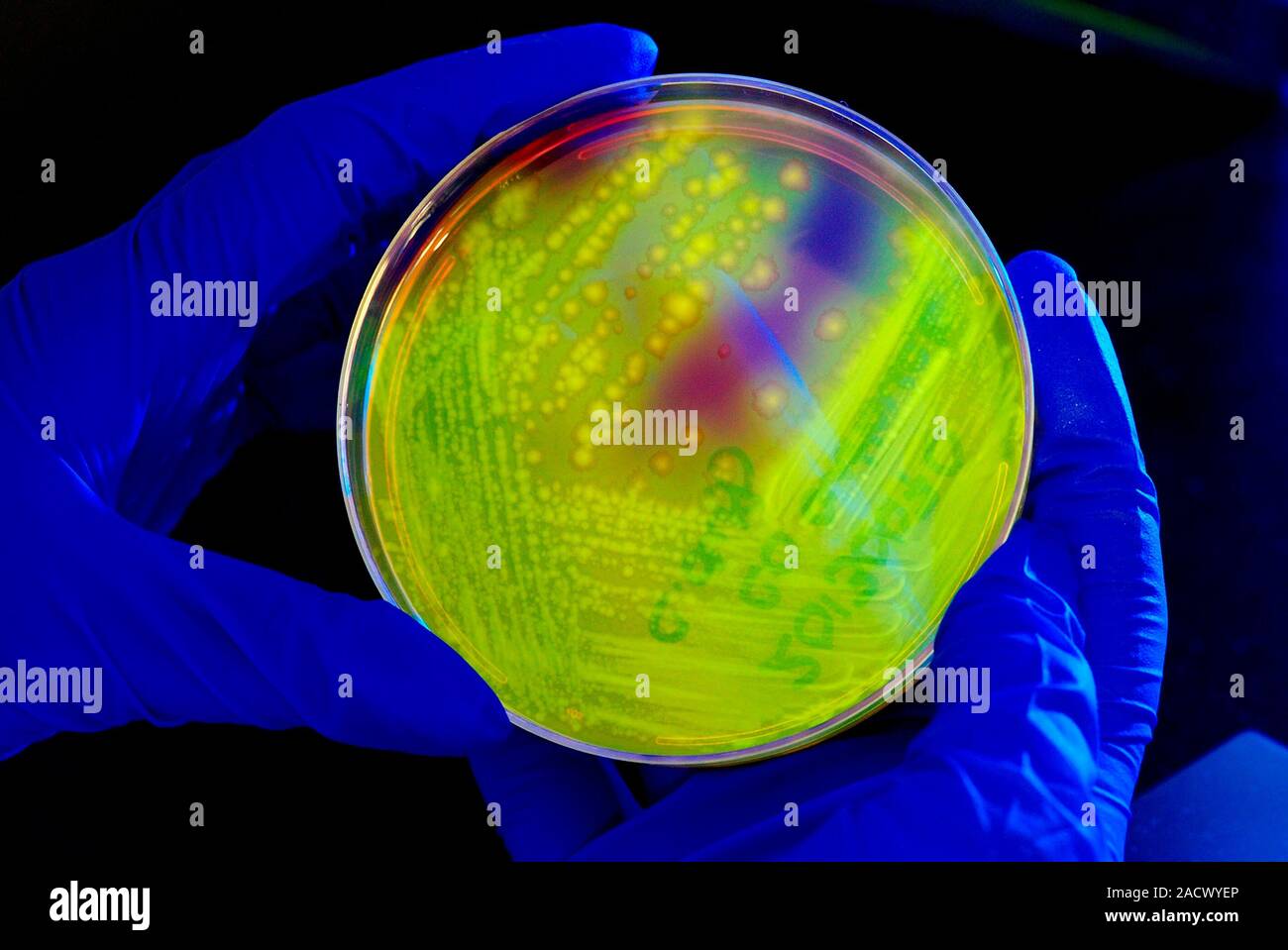 Clostridium difficile bacterial culture in a petri dish. The agar used ...