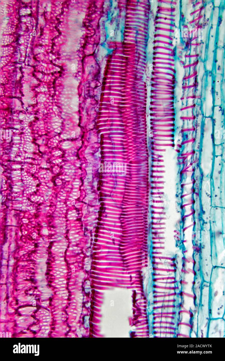 Pumpkin stem. Light micrograph of a section through the stem of a