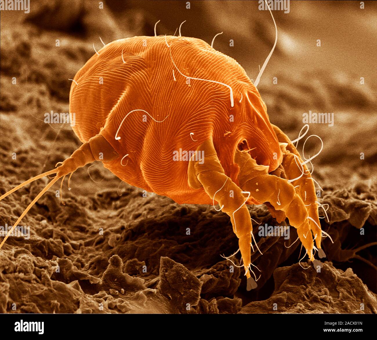 Scanning electron micrograph of an ear mite (Otodectes cynotis). Ear