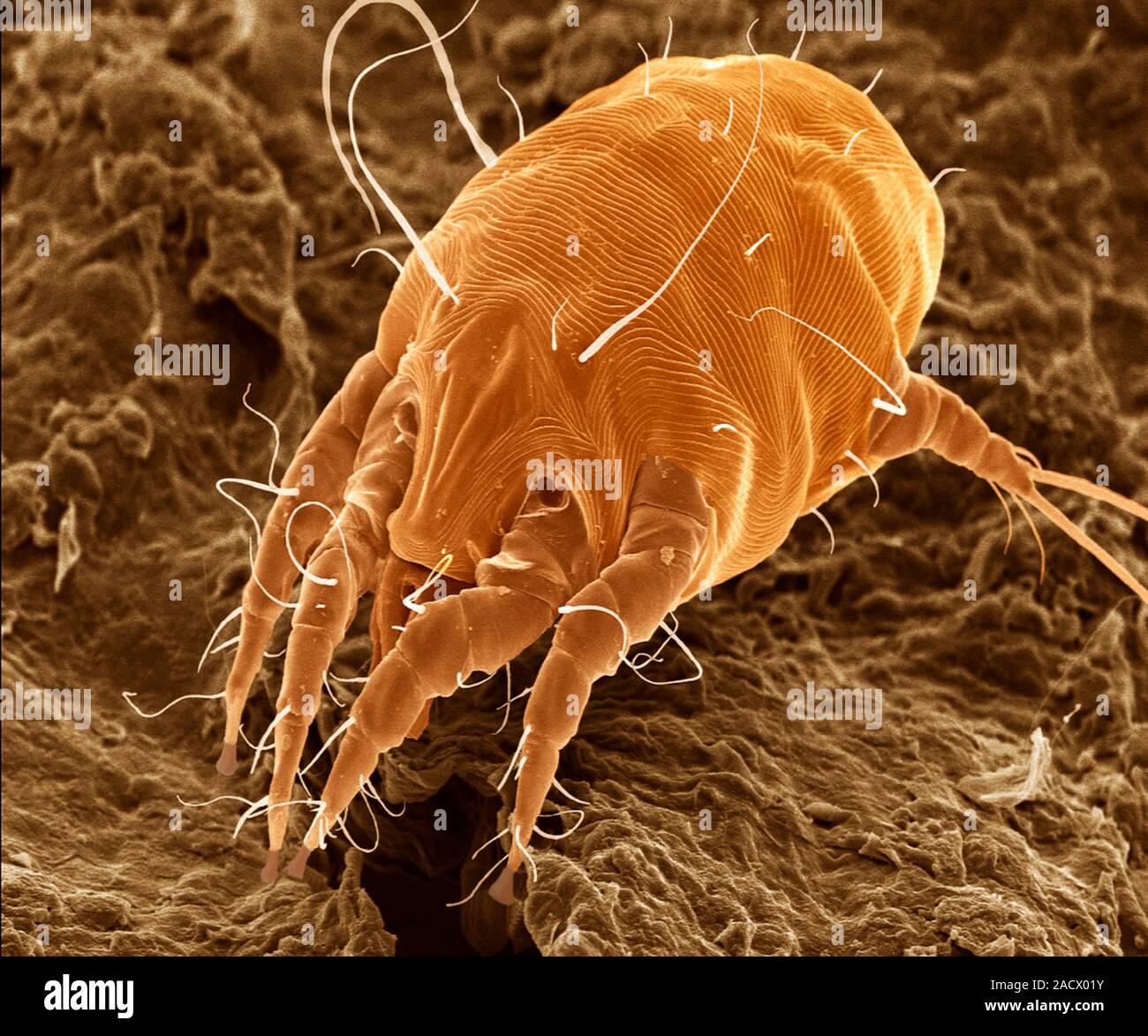 Scanning electron micrograph of an ear mite (Otodectes cynotis). Ear mites live in the ears of