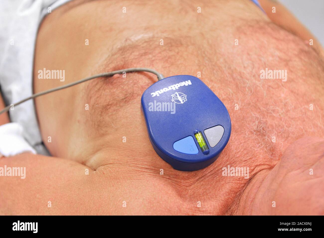 Heart and pacemaker monitoring system. This device detects the presence ...