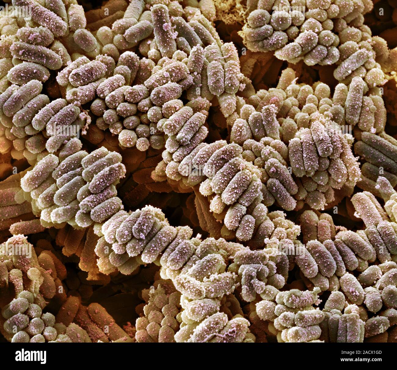 E. coli bacteria. Coloured scanning electron micrograph (SEM) of ...