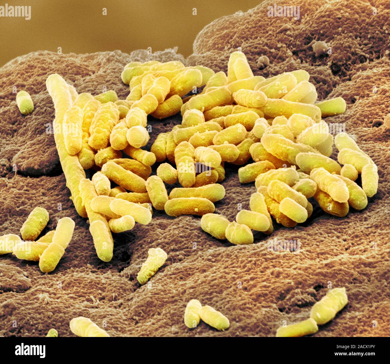 Lactobacillus Bacteria Coloured Scanning Electron Micrograph Sem Of Lactobacillus Delbrueckii 2112