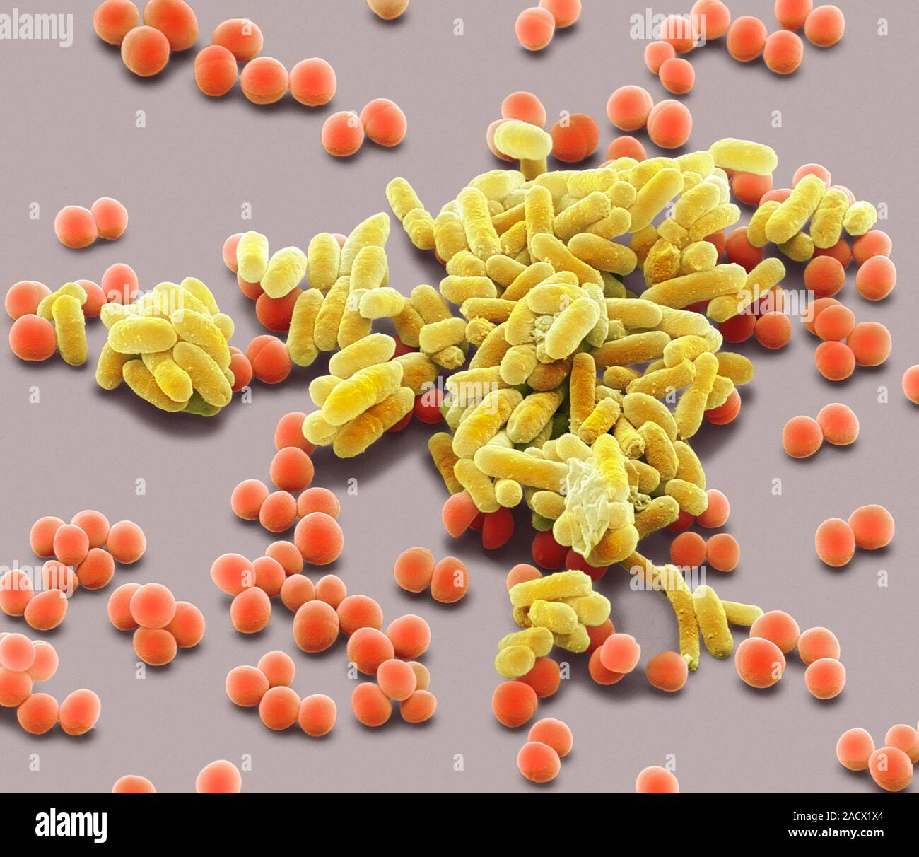 дерматический стафилококк. золотистый стафилококк больнице. золотистый стафилококк mrsa. золотистый стафилококк больнице. золотистый стафилококк больнице.