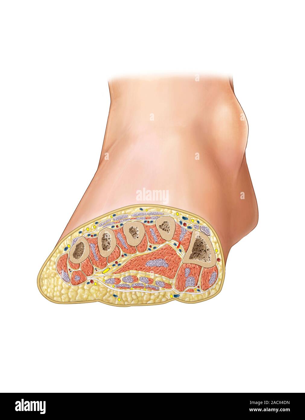 Illustration of the muscles of the foot. This is a cross-section of the ...