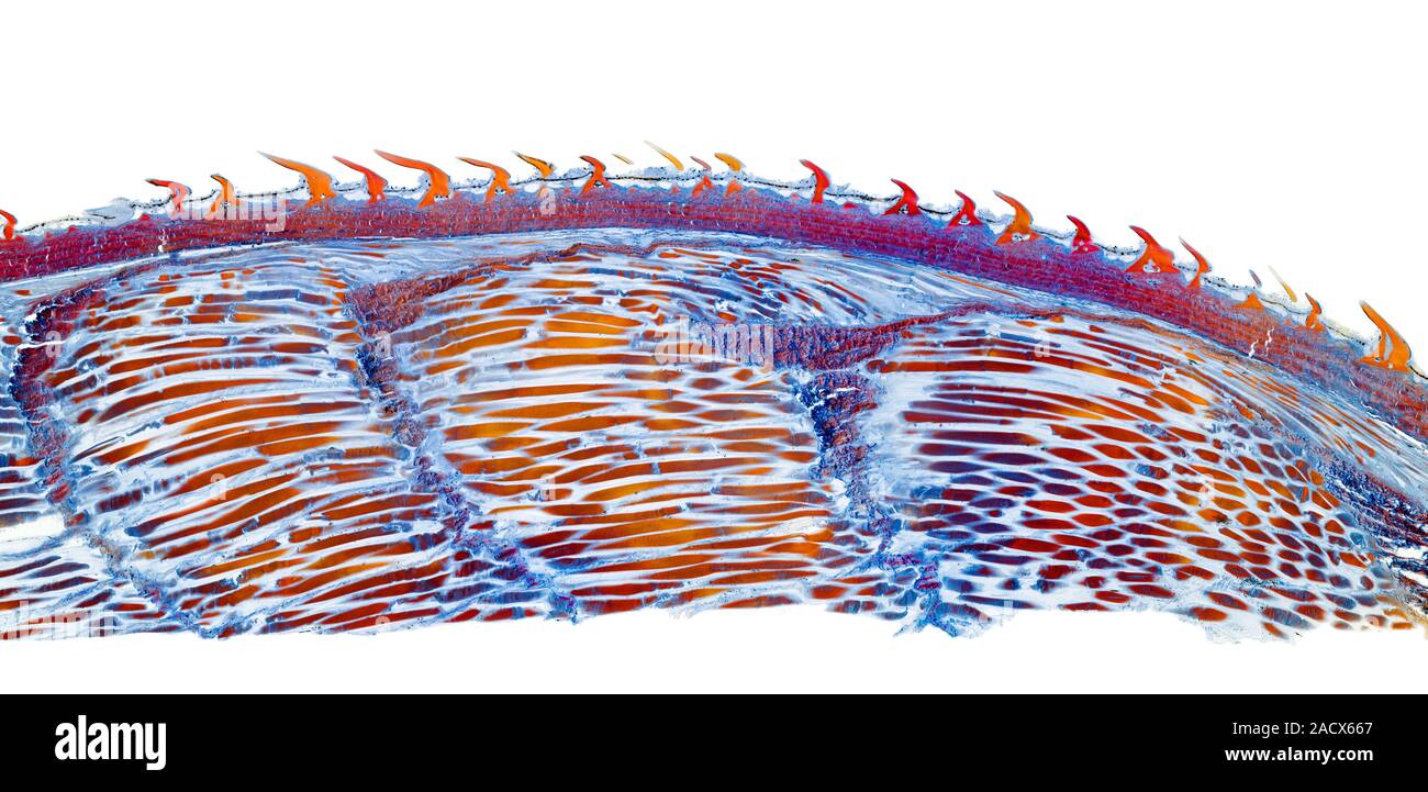 Dogfish skin. Light micrograph of a section through the skin of a ...