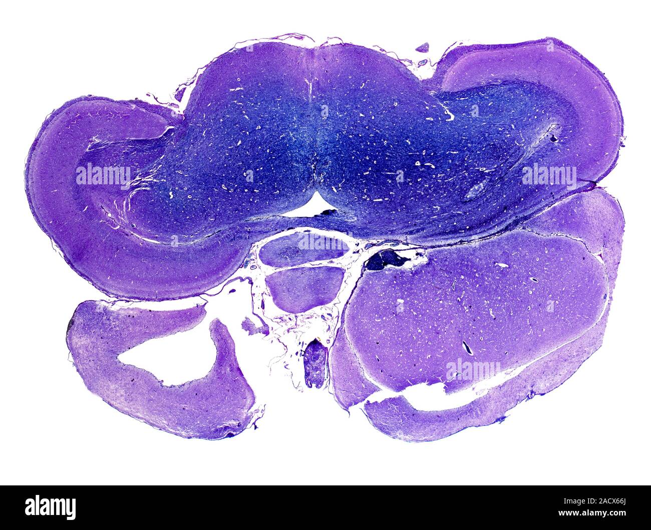 Bird brain. Light micrograph of a section through the brain of a brown ...