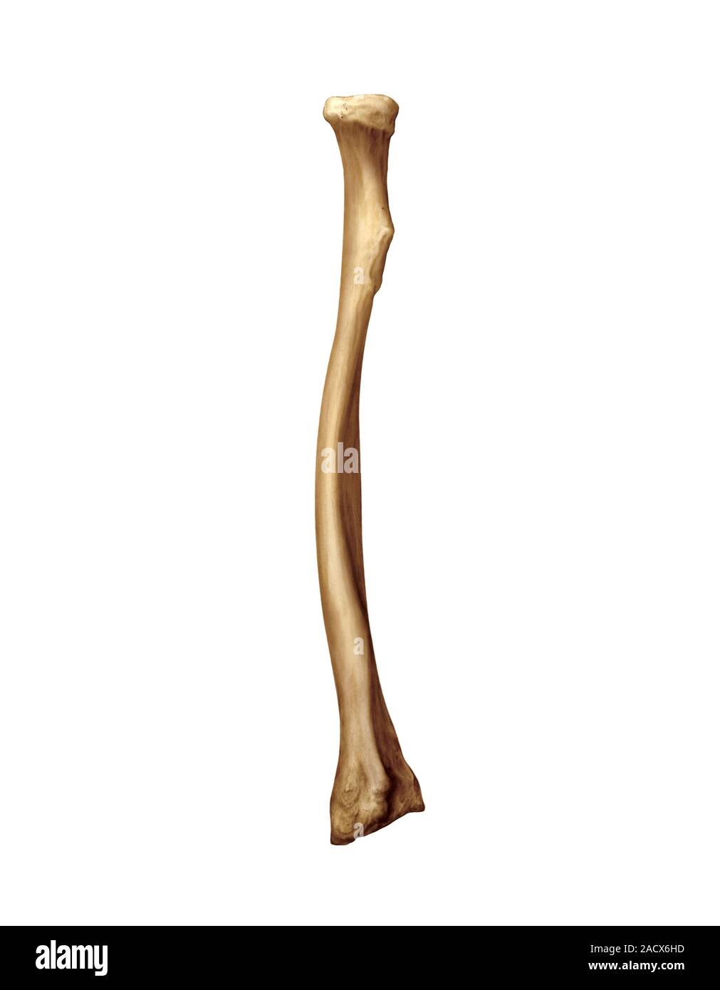 Illustration of the radius bone. This posterior view illustration is from 'Asklepios Atlas of