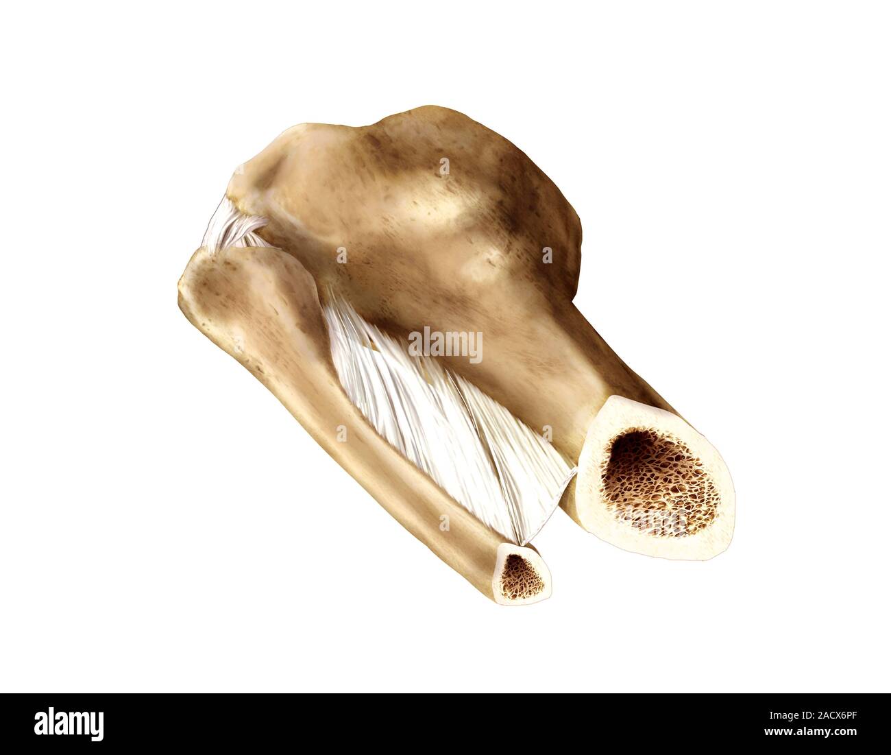 Illustration of the distal view of the tibia and the fibula. This ...