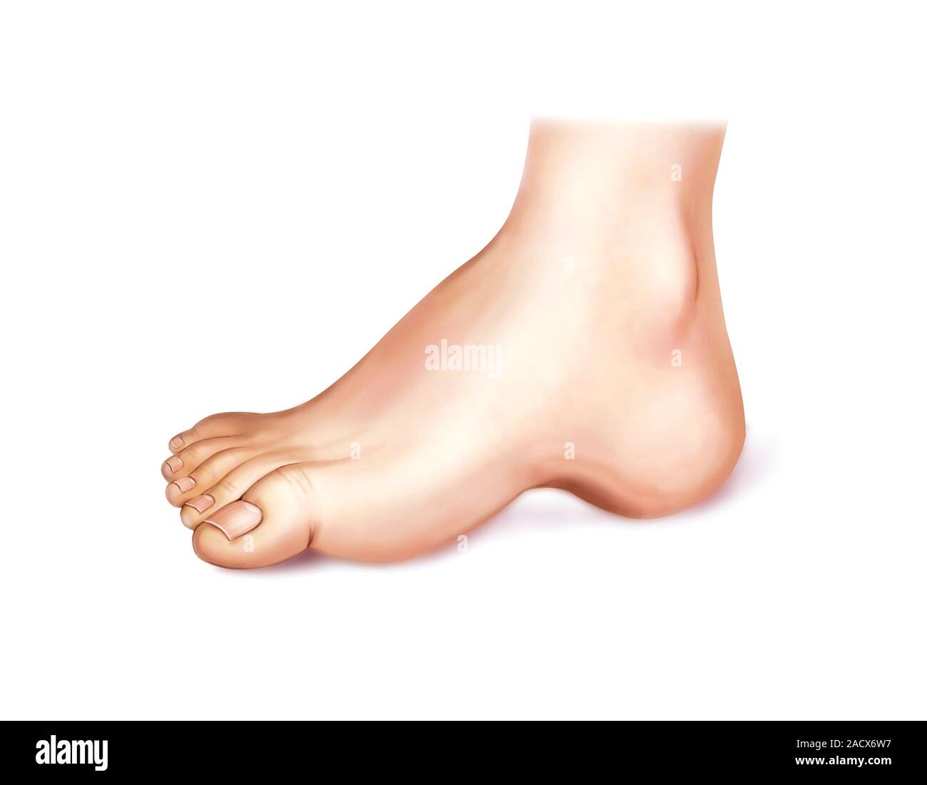 Illustration of the talipes or foot deformations from the anatomical