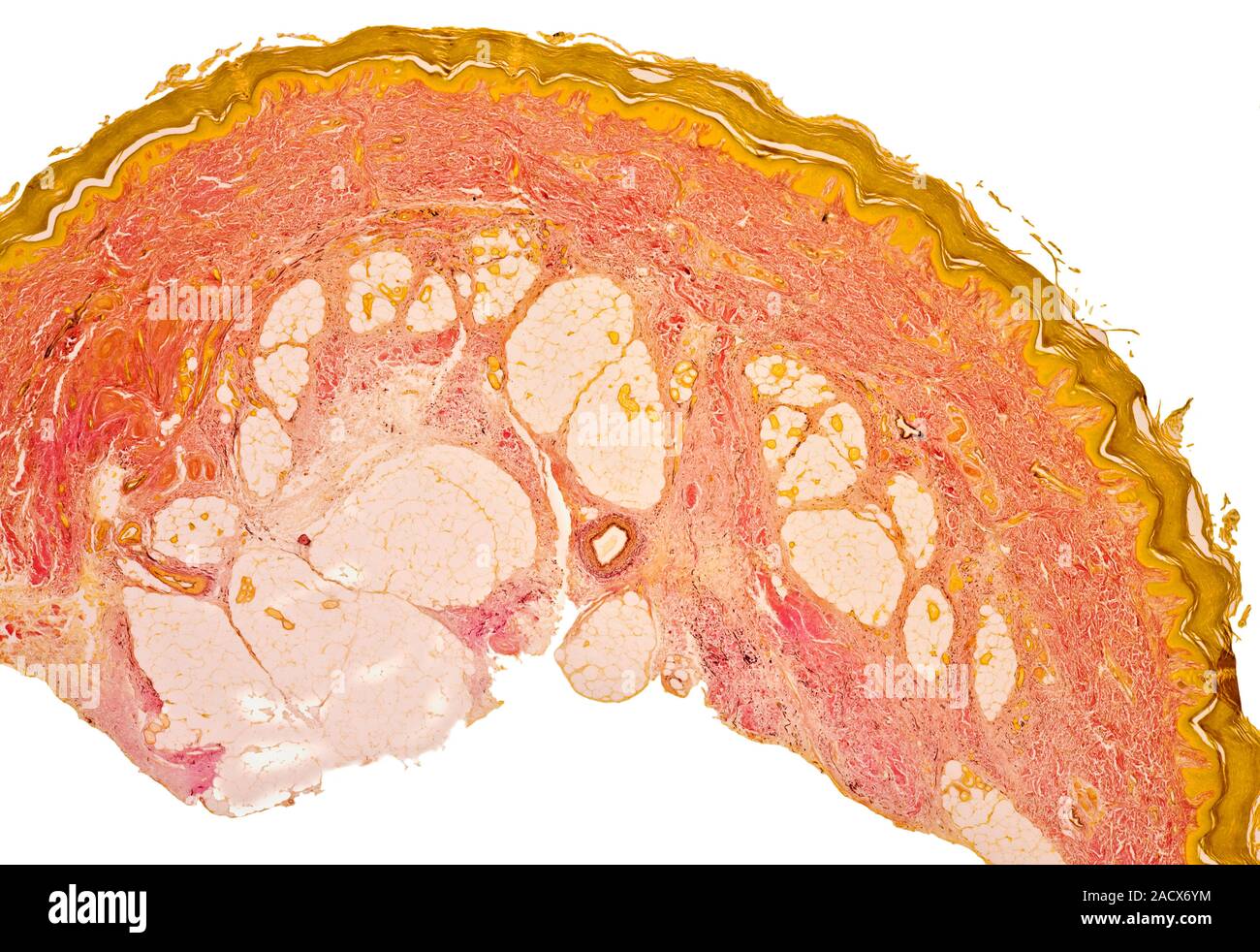 Skin. Light micrograph of a section through a human fingertip showing ...