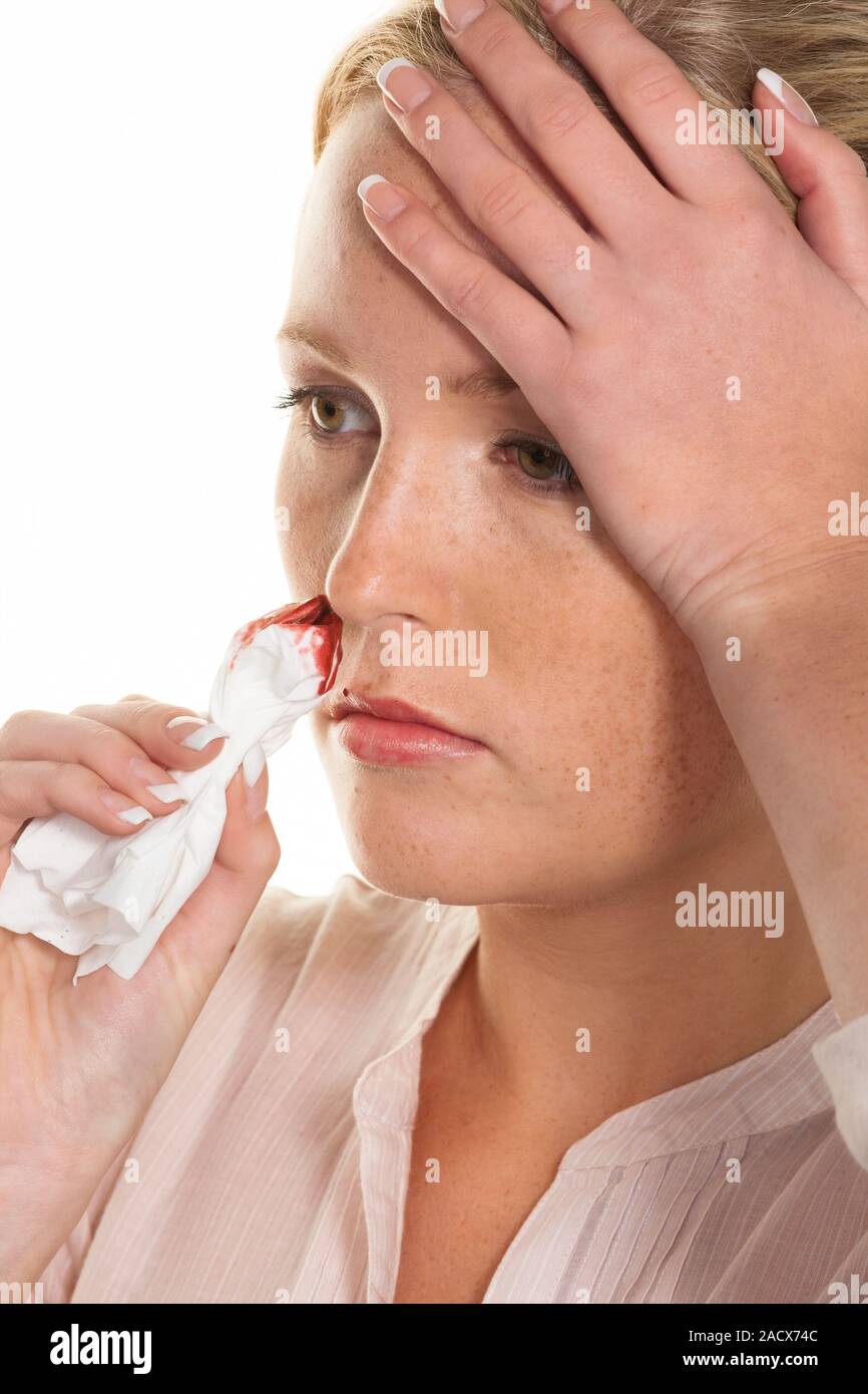 young woman has noses bleeding Stock Photo Alamy