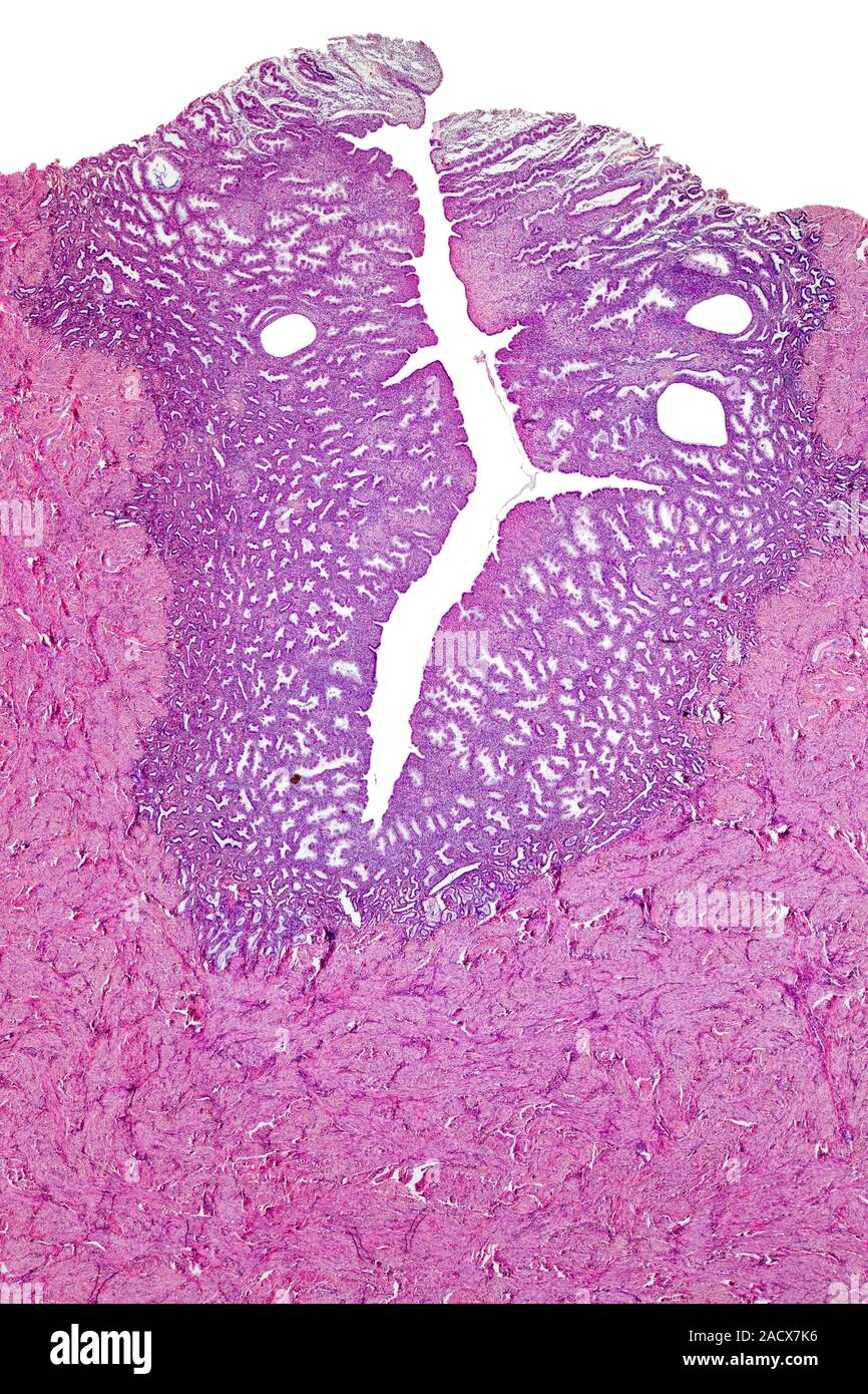 Human uterus. Light micrograph of a transverse section through the