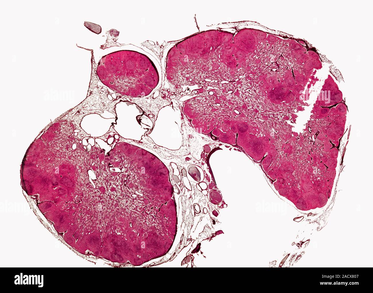 Lung. Light micrograph of a section through a rabbit lung. The lungs ...
