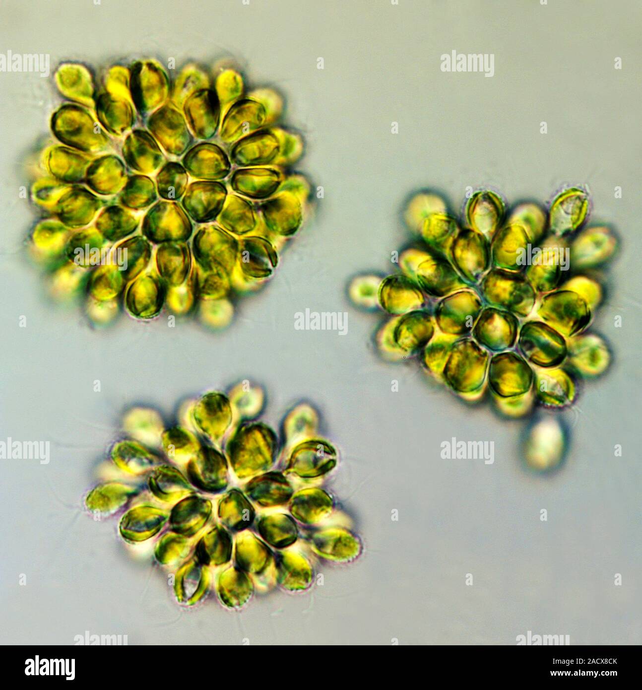 Goldenbrown algae. Polarised light micrograph of three Synura uvella