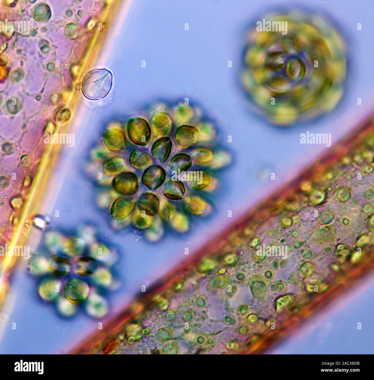 Goldenbrown algae. Polarised light micrograph of three Synura uvella