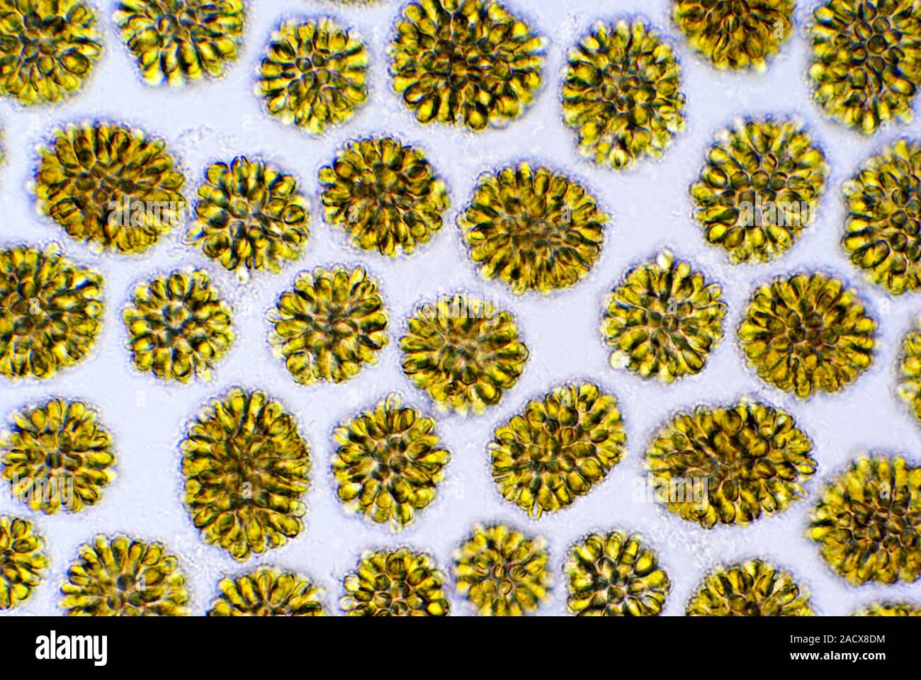 Goldenbrown algae. Bright field light micrograph of Synura uvella