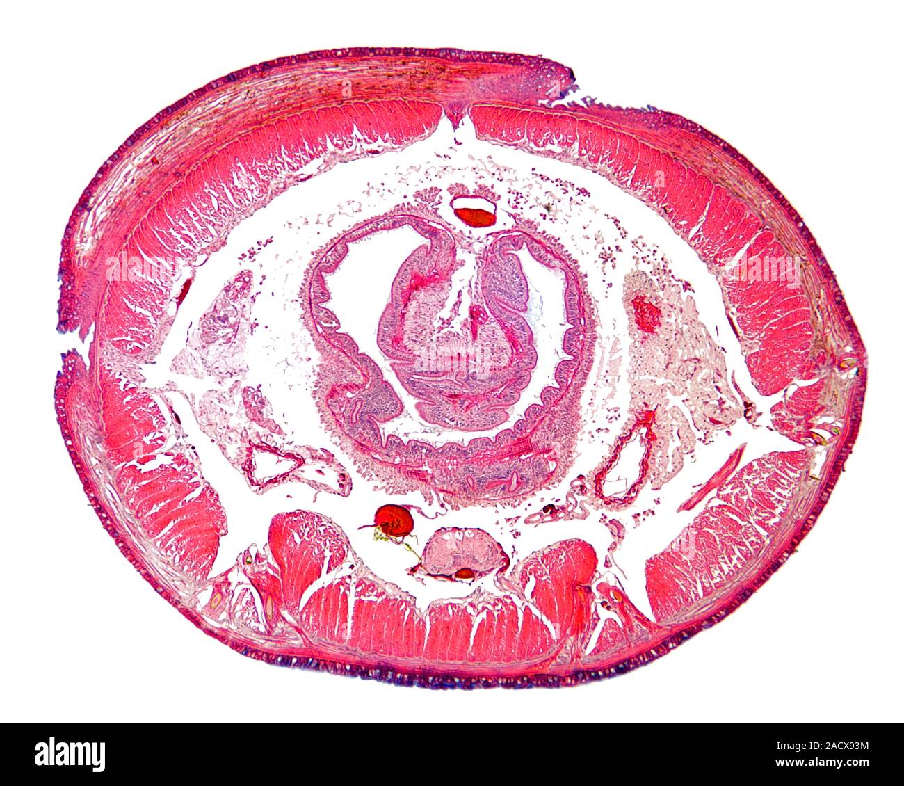 Square-tailed worm. Light micrograph of a transverse section through a ...