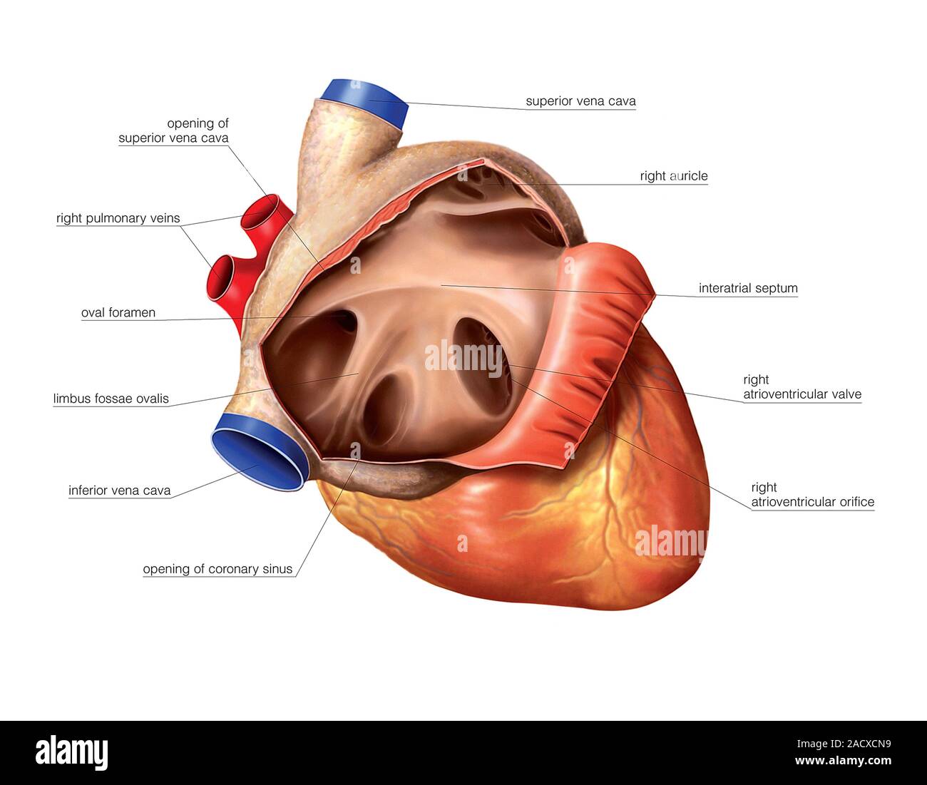 Illustration of the Heart and right atrium of newborn. This anterior ...