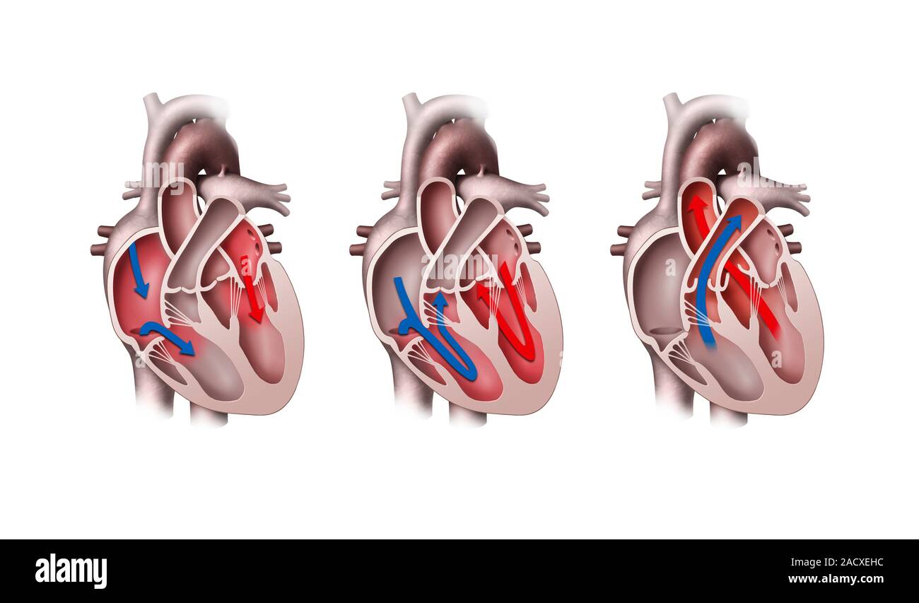 Heart contraction cycle. Artwork of the pumping mechanism of the human ...