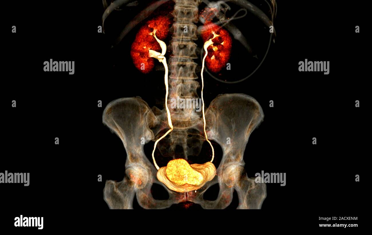 Healthy urinary system, coloured 3D computed tomography (CT) scan