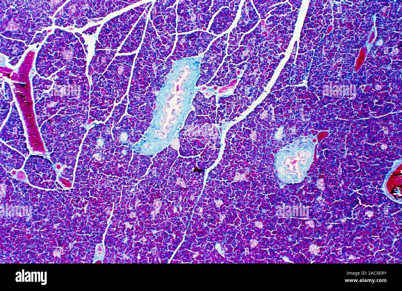 Light micrograph of a section through the pancreas. The pancreas secretes digestive enzymes into