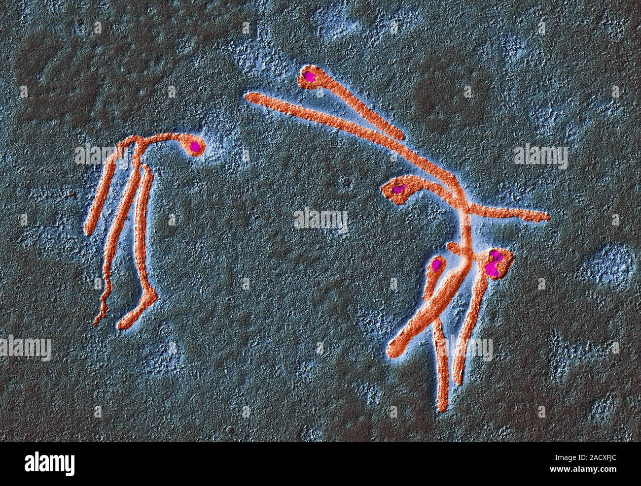 Ebola virus particles, coloured transmission electron micrograph (TEM). Each particle consists of a ribonucleic acid (RNA) genome within a nucleocapsi Stock Photo