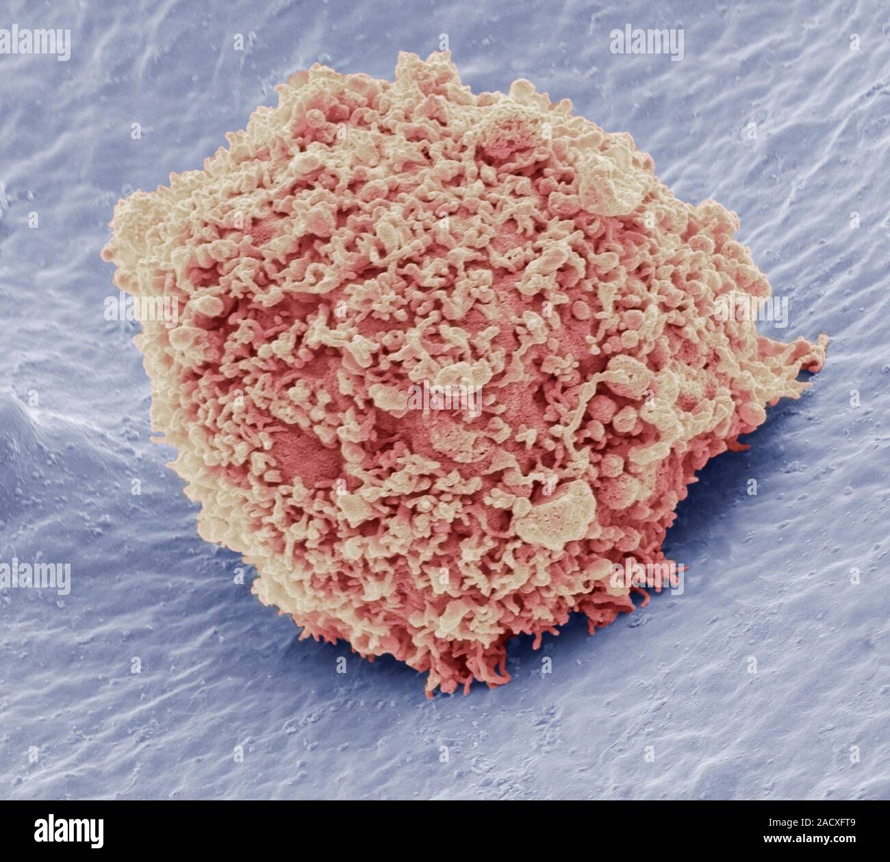 Mesenchymal stem cell. Coloured scanning electron micrograph (SEM) of a