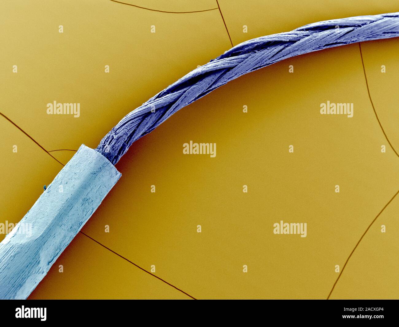 Medical suture. Coloured scanning electron micrograph (SEM) of a