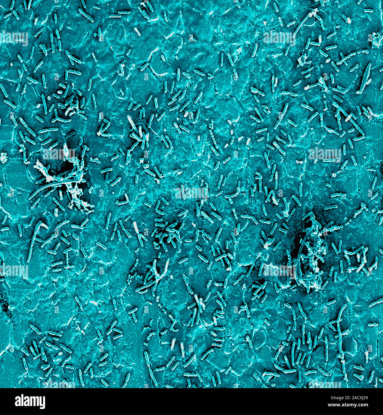 Bacteria on stainless steel, coloured scanning electron micrograph (SEM