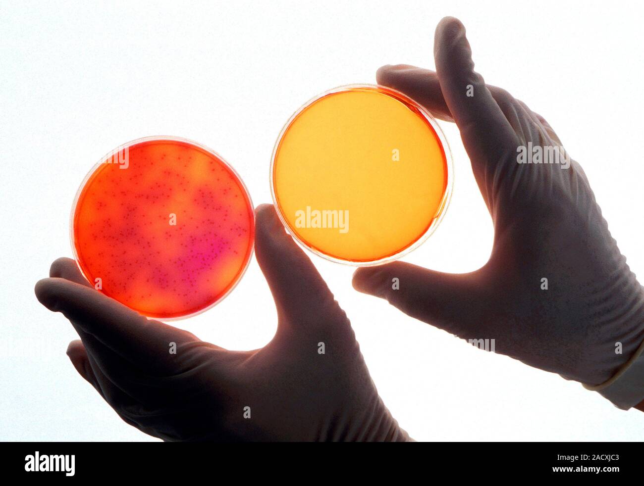 Salmonella sterilisation testing. Closeup of a microbiologist handling