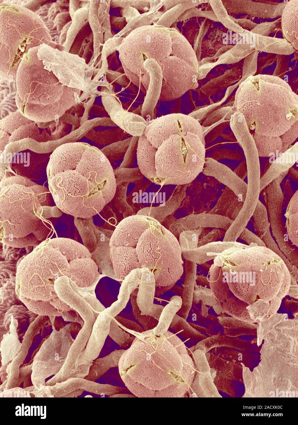 Azalea (Rhododendron sp.) pollen, coloured scanning electron micrograph ...