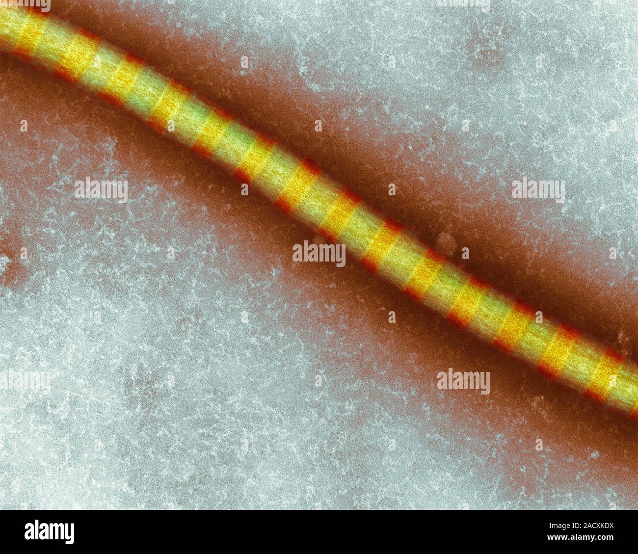 Collagen fibril. Coloured scanning electron micrograph (SEM) of a ...