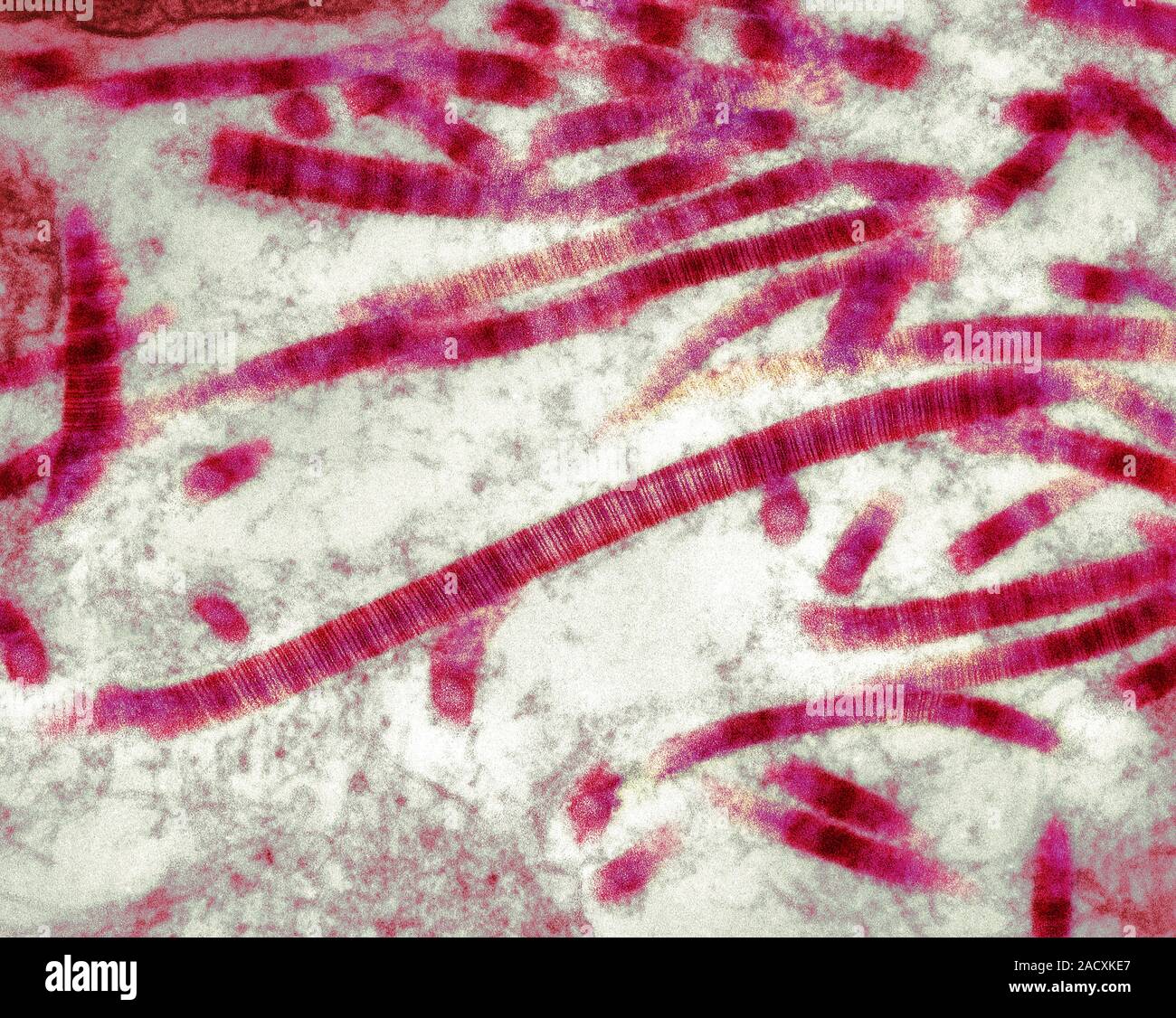 Collagen fibrils. Coloured scanning electron micrograph (SEM) of ...