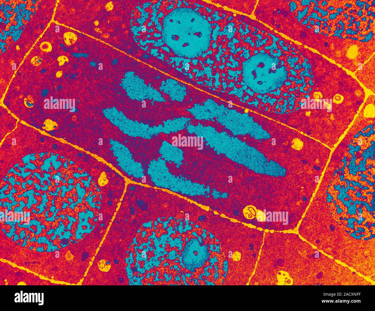 Onion root tip. Coloured transmission electron micrograph (TEM) of a