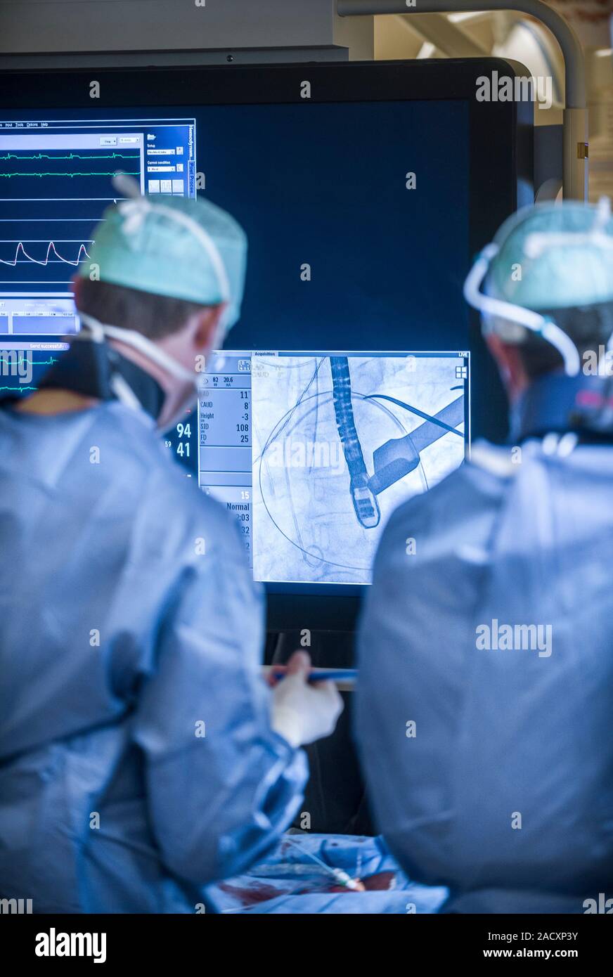 Cardiac catheterization. Surgeons using Xrays for guidance as they