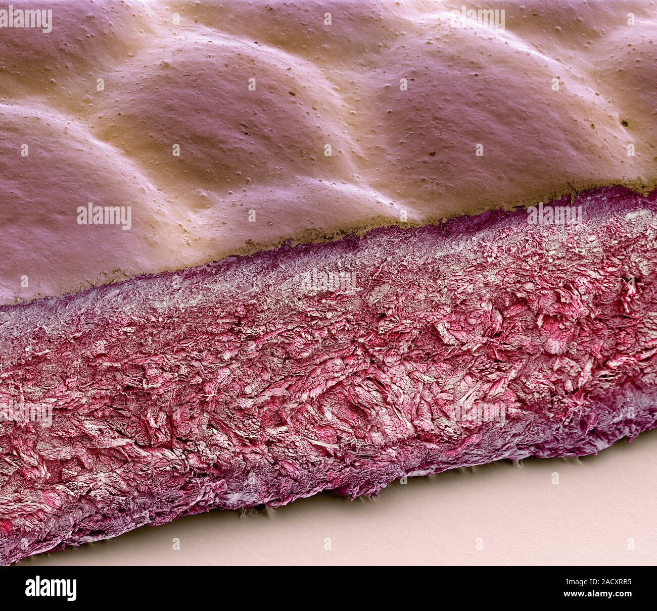 Coloured scanning electron micrograph (SEM) of a section through top ...