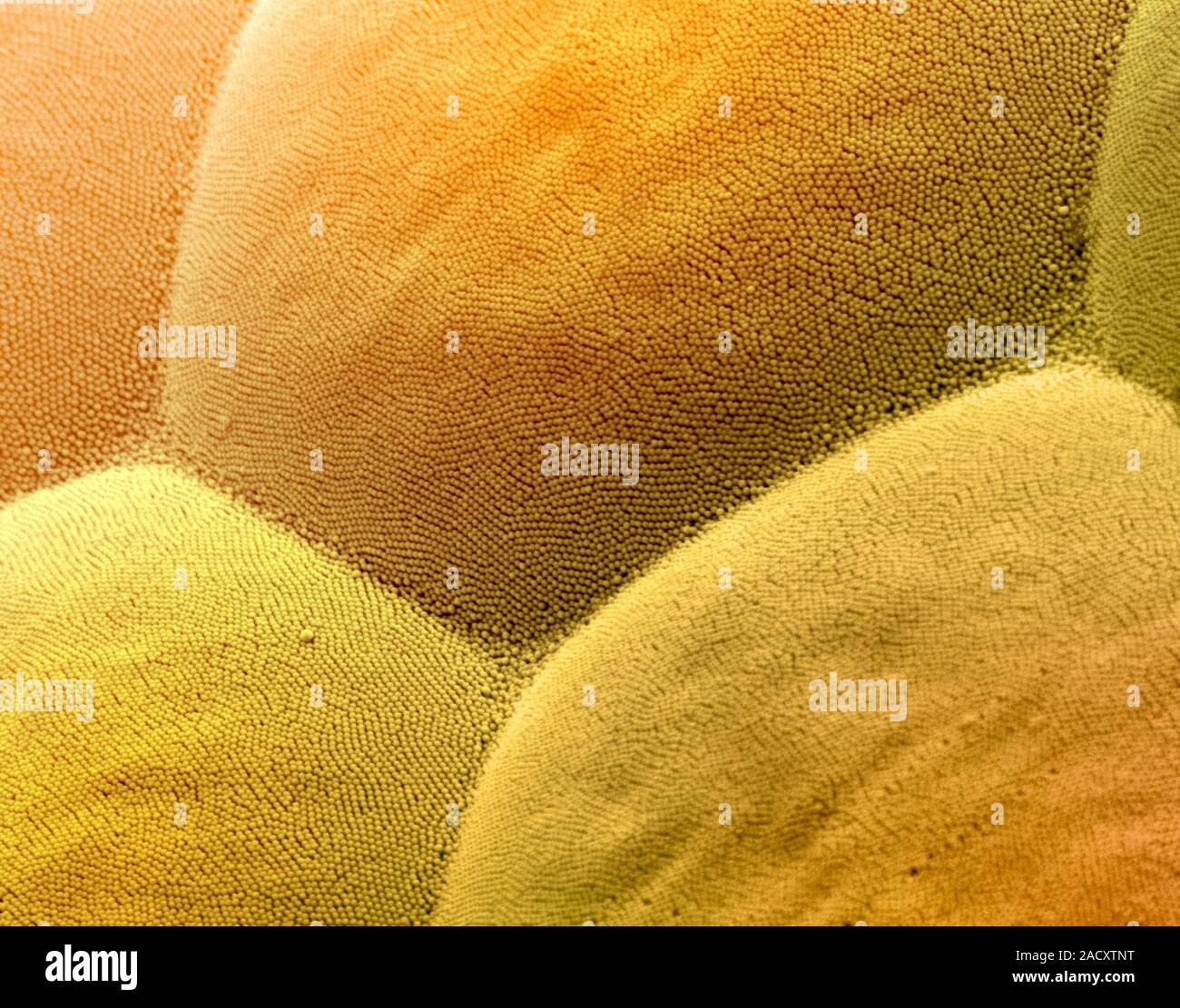 Insect compound eye lenses, coloured scanning electron micrograph (SEM
