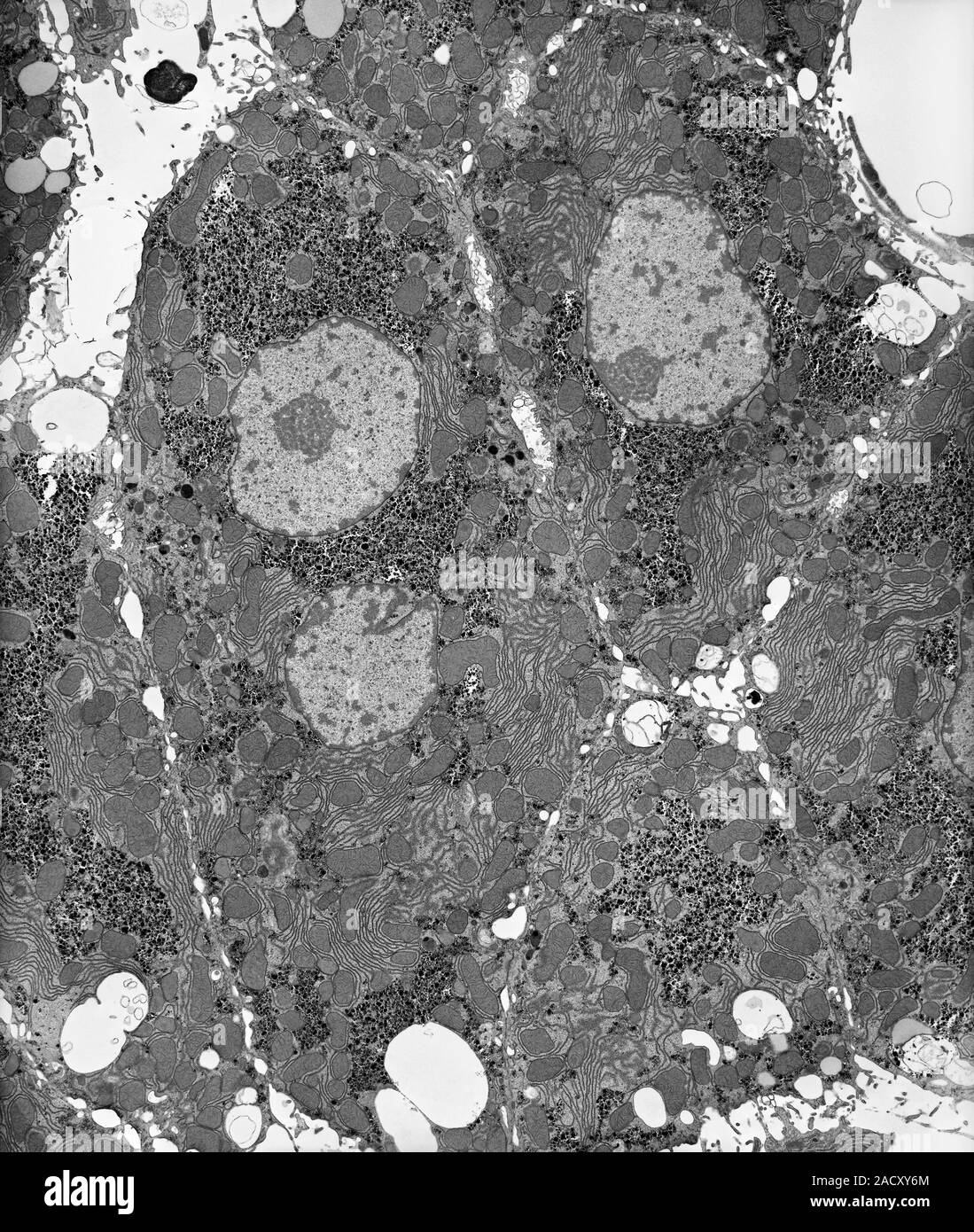 Liver tissue hepatocytes. Transmission electron micrograph (TEM) of a section through liver