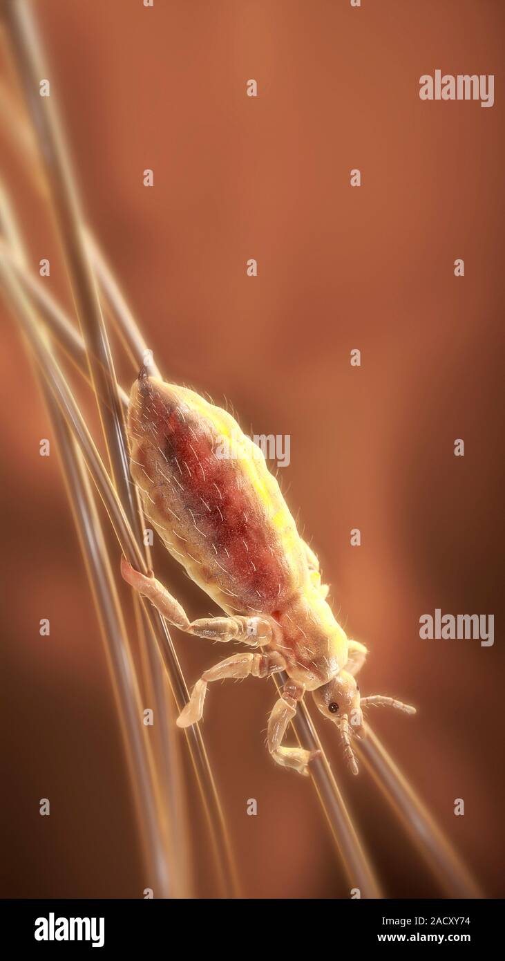 Atwork of a head louse (Pediculus humanus capitis) clinging to human ...