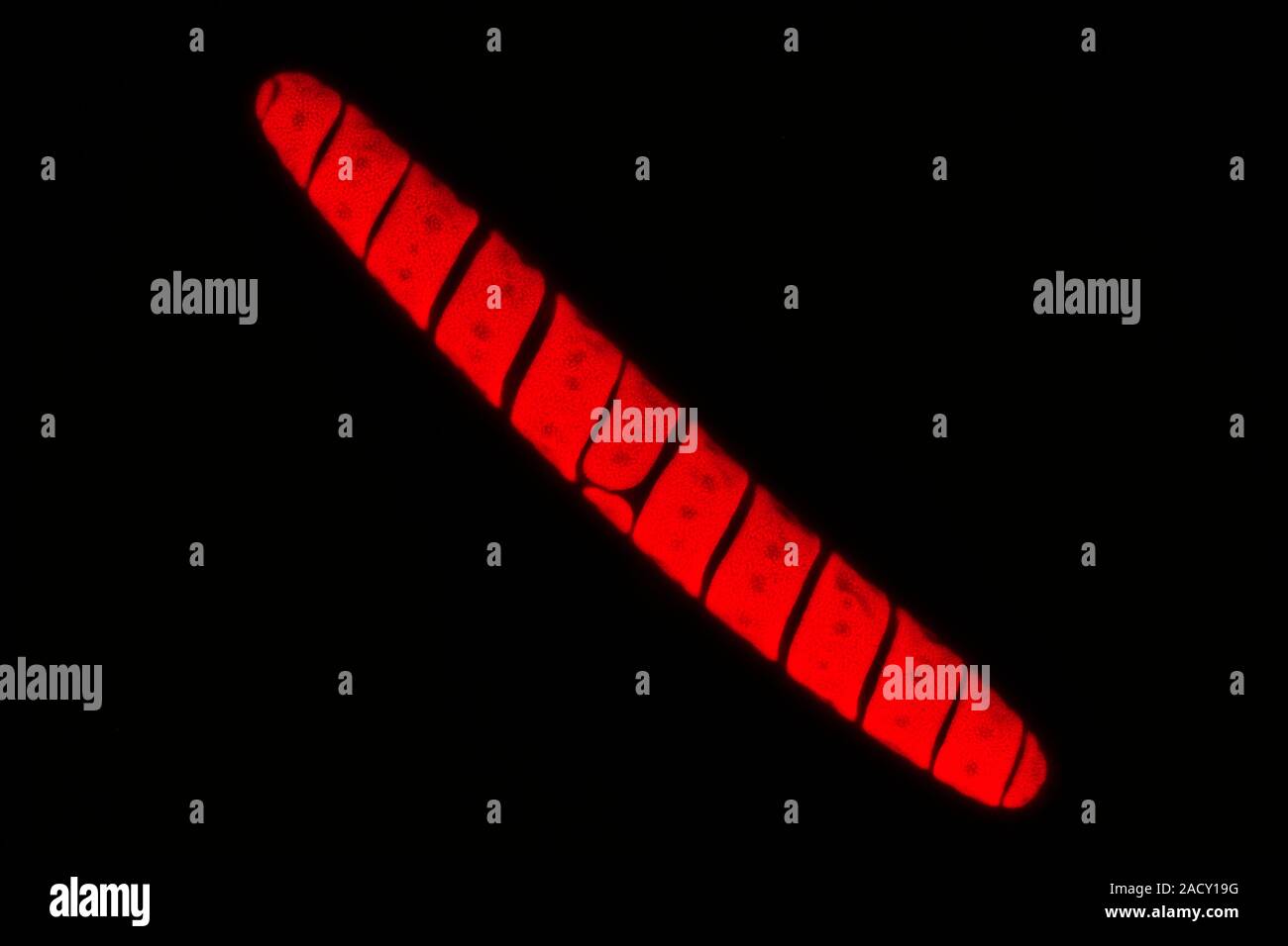 Light micrograph of a Spirotaenia sp. freshwater green alga, showing