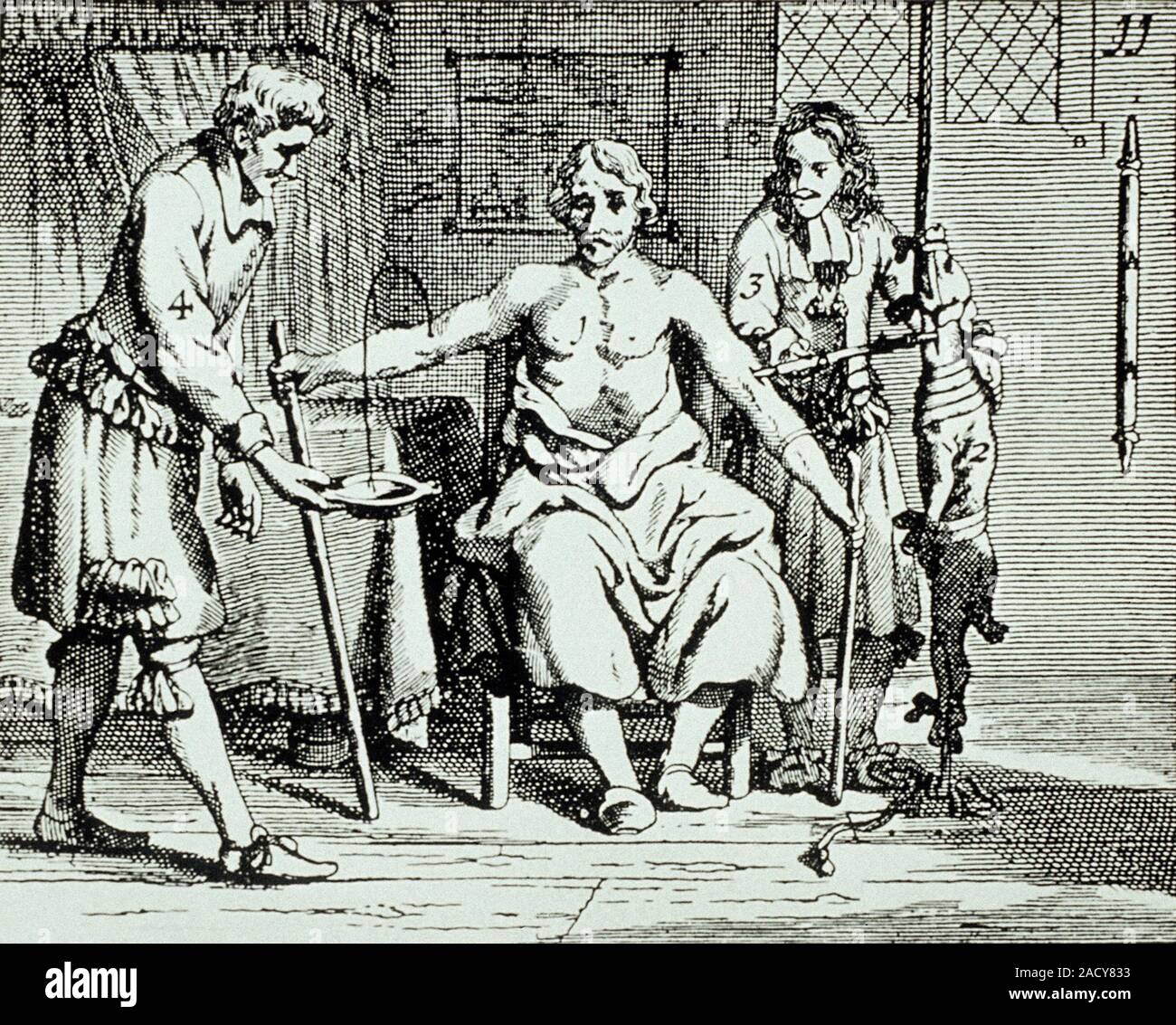 Animal-human blood transfusion. 17th-century artwork showing blood ...